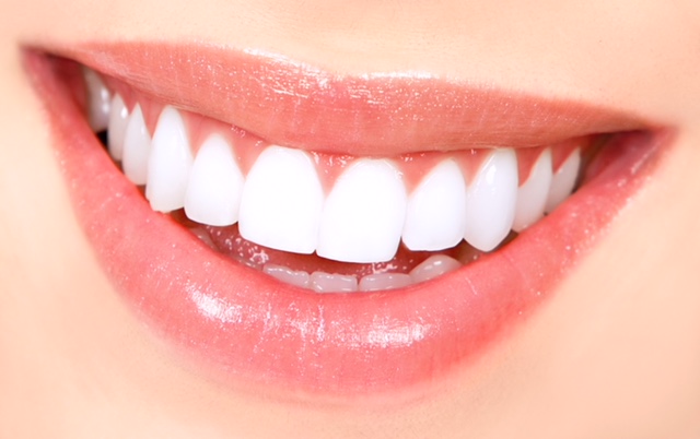 Woman-teeth
