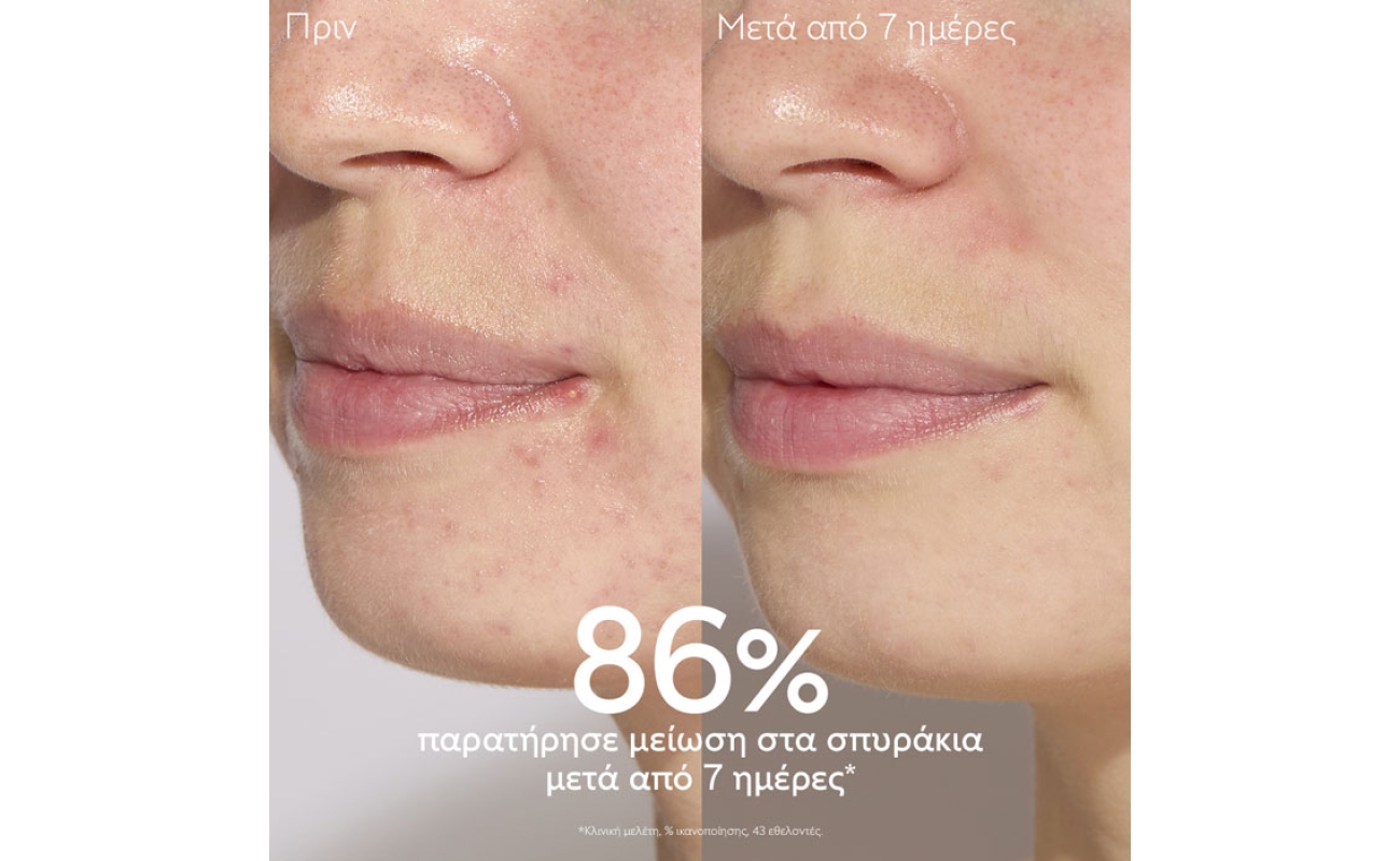 caudalie vinopure blemish control salicylic serum 30ml 1