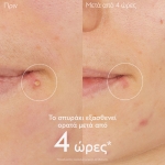 caudalie vinopure salicylic spot solution 15ml 2